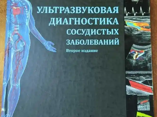 Книга Ультразвуковая диагностика сосудистых заболеваний, Душанбе