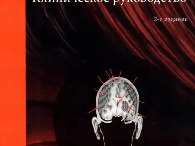 Книга Инсульт Клиническое руководство, Душанбе