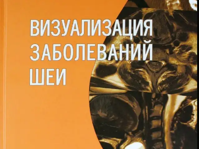 Книга визуализация заболеваний шеи, Душанбе