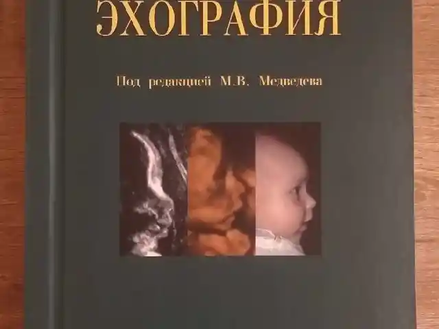 Книга Пренатальная эхо-графия на заказ, Душанбе