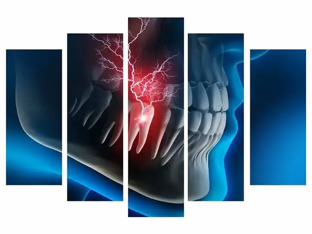 Модульные 3d картины стоматология на заказ, Душанбе