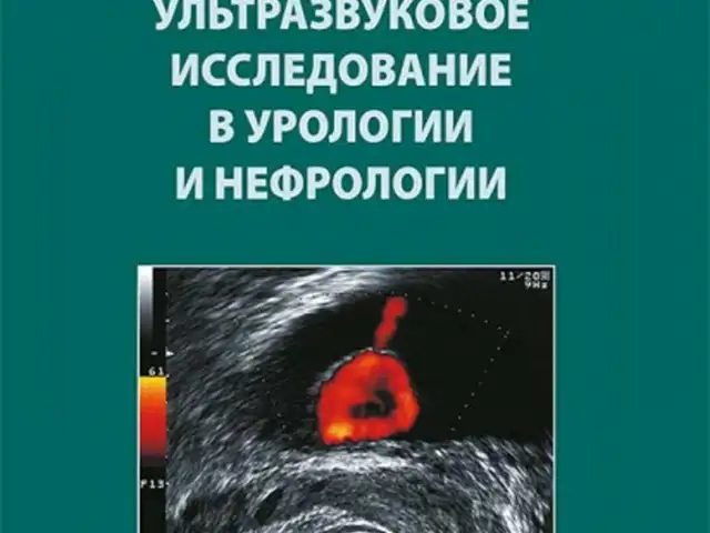Ультразвуковое исследование в урологии и неврологии, Душанбе