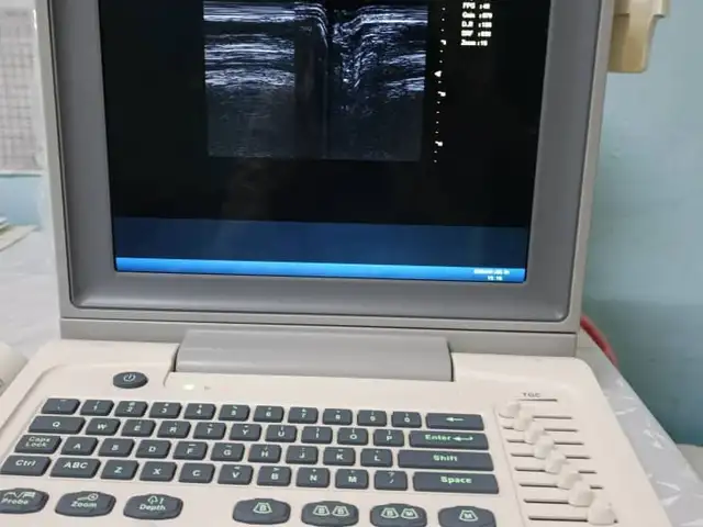 Аппарат Узи, Турсунзаде