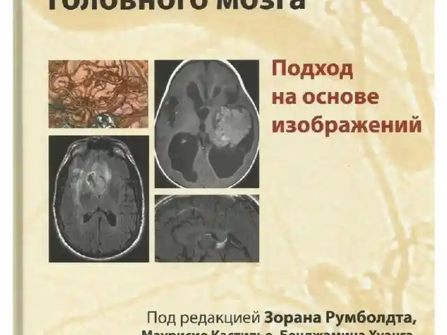 Книга КТ и МРТ визуализация головного мозга, Душанбе