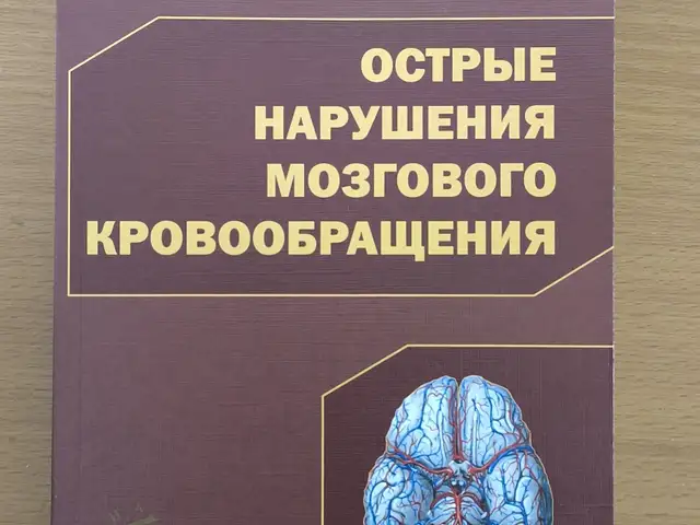 Книга Острые нарушения мозгового кровообращения, Душанбе