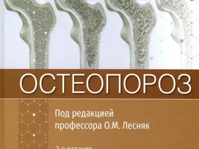 Книга Остеопороз, Душанбе