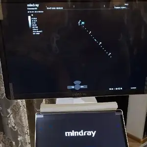 Аппарат УЗИ Mindray Consona N6 с 4 датчиками, Душанбе