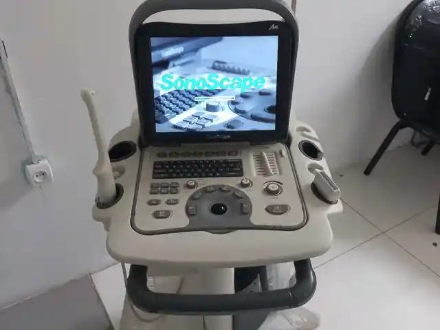 Аппарат УЗИ Sonoscape A6, Душанбе