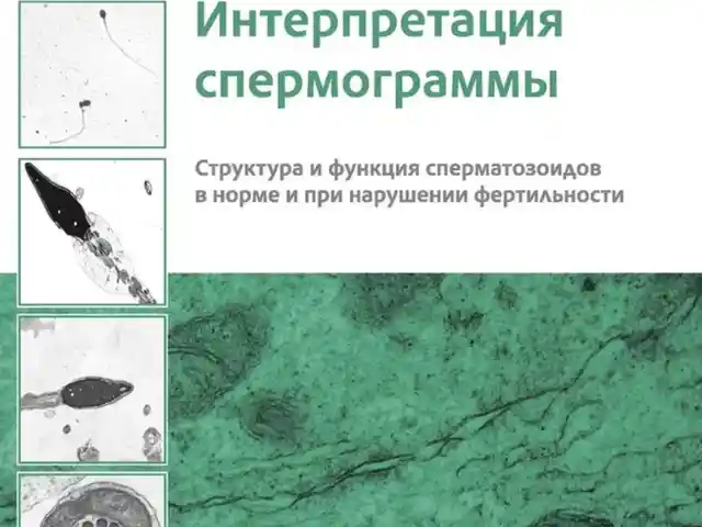 Книга Интерпретация спермограммы, Душанбе