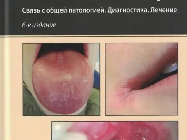 Книга Заболевания слизистой оболочки рта, Душанбе