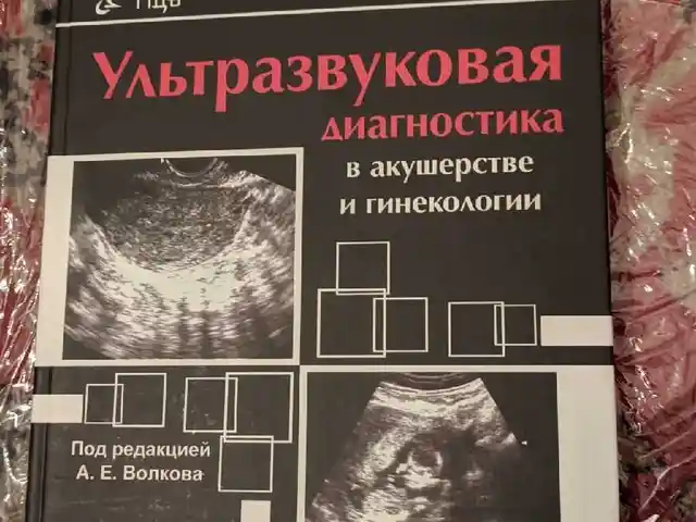 Книга Ультразвуковая диагностика в акушерстве и гинекологии, Душанбе