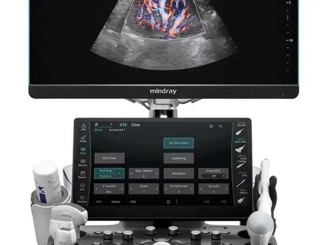 Аппарат для УЗИ MINDRAY CONSONA N9, Душанбе