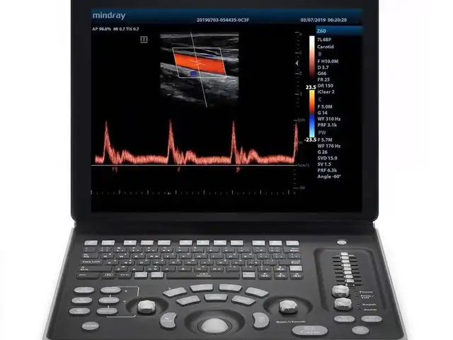 Аппарат для УЗИ Mindray DP50, Худжанд