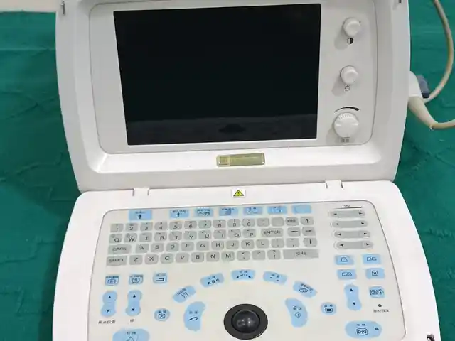 УЗИ аппарат Mindray, Хуҷанд