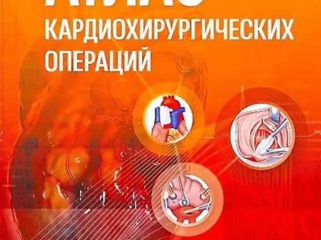 Книга Атлас кардиохирургических операций на заказ, Душанбе