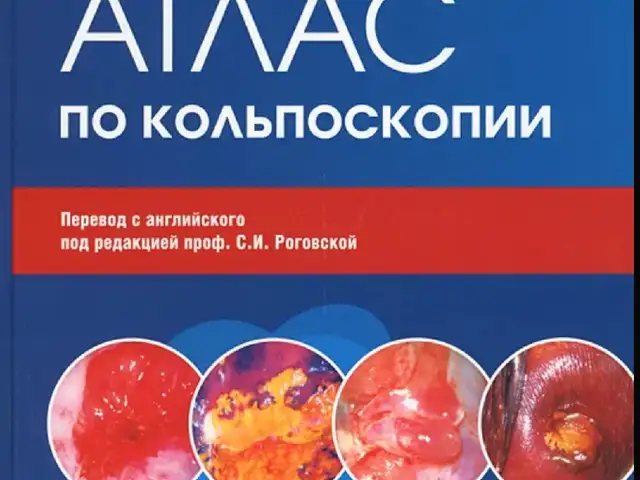 Книга Атлас по кольпоскопии, Душанбе