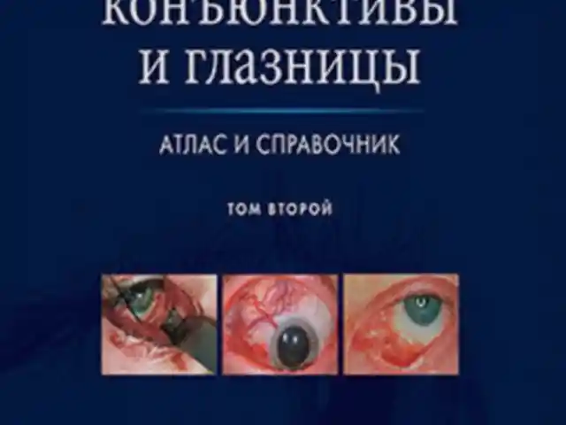 Атлас и справочник Опухоли век конъюнктивы и глазницы, Душанбе