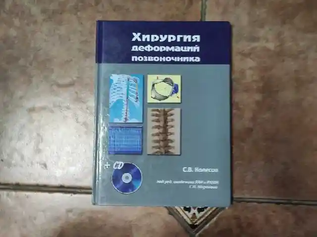Книга - Хирургия деформаций позвоночника, Душанбе